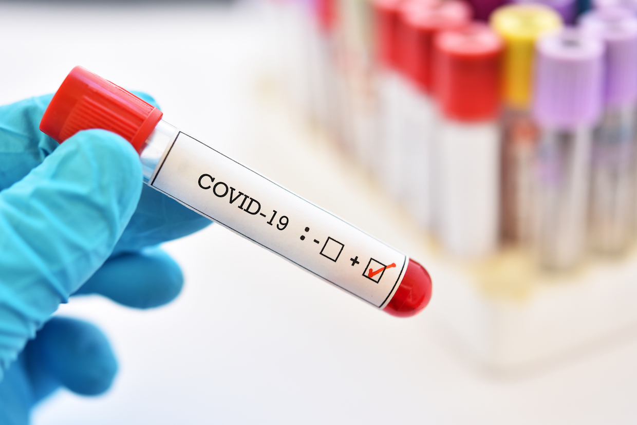В Мариуполе с подозрением на коронавирус госпитализировали 4 человек, в том числе ребенка