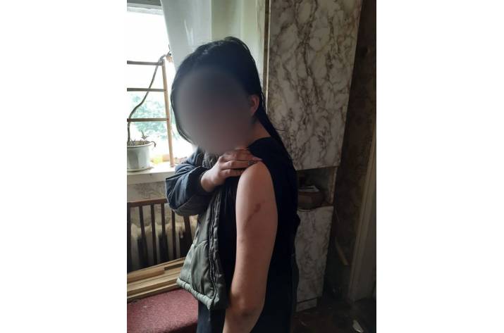 В Луганской области мать держала дочь на цепи