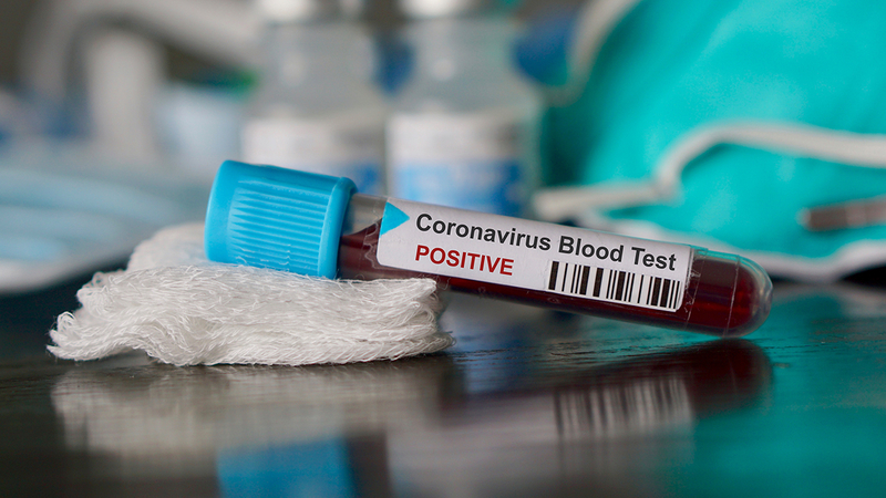 В Украине - больше 500 новых случаев коронавируса