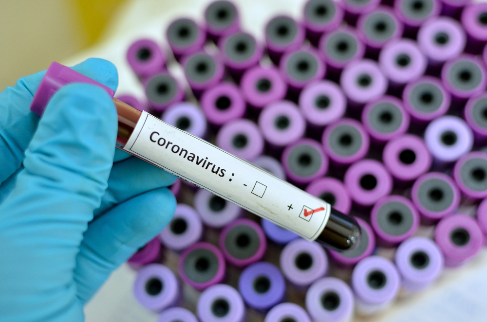 В Украине - плюс 455 заболевших коронавирусом, умерло 272 человека