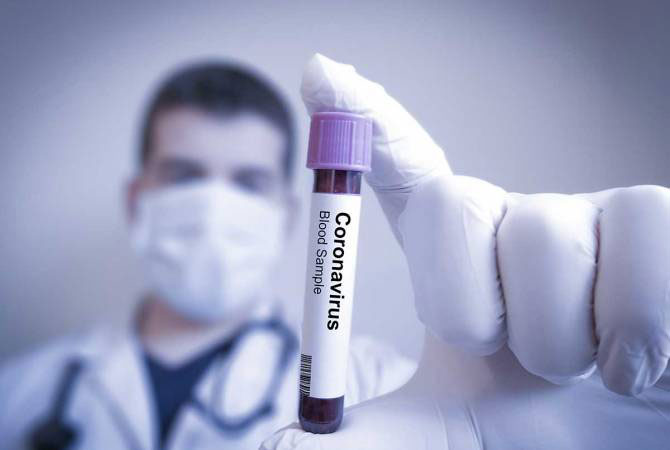 На Луганщине за сутки 74 новых случая коронавируса
